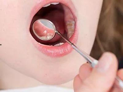 吃瓜嘴有口疮,揭秘口腔健康小贴士