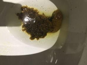 吃瓜后大便成形,大便成形背后的秘密